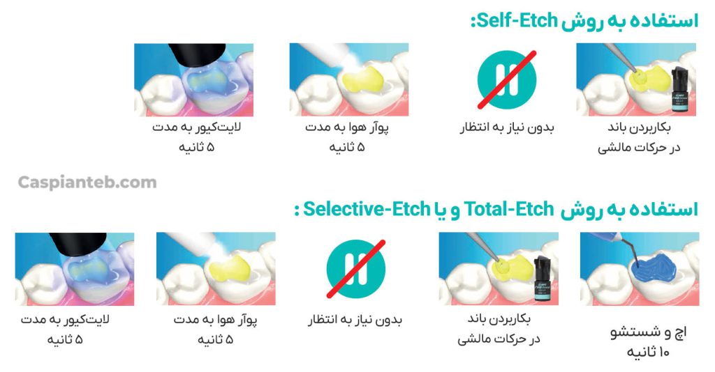 باند یونیورسال کوراری 
